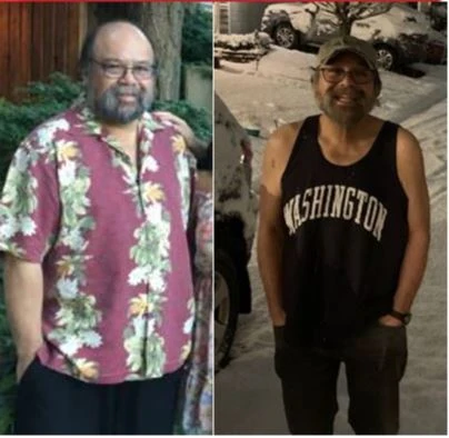 Keith Before and After
