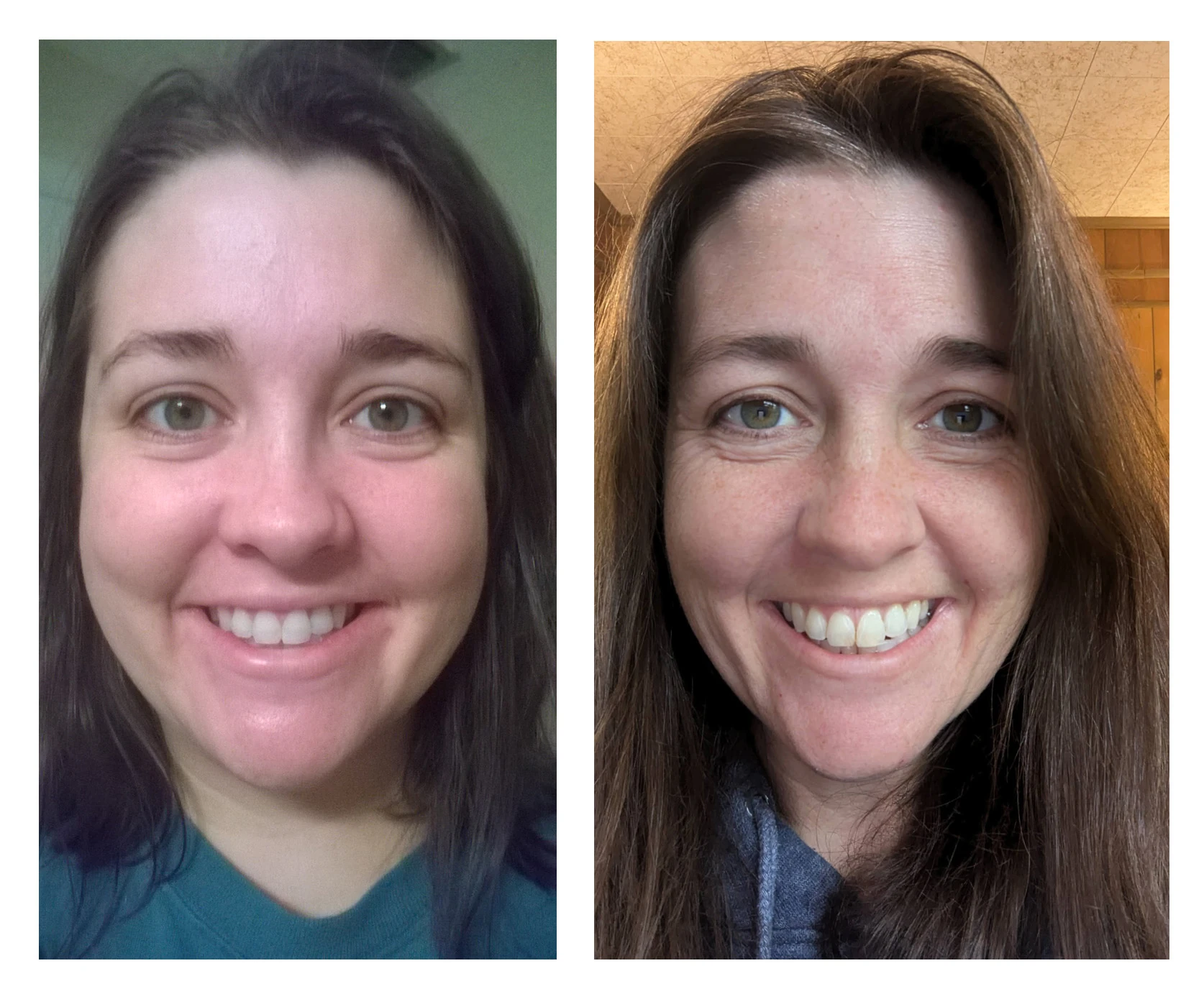 Overcoming Procrastination (To Lose Weight)